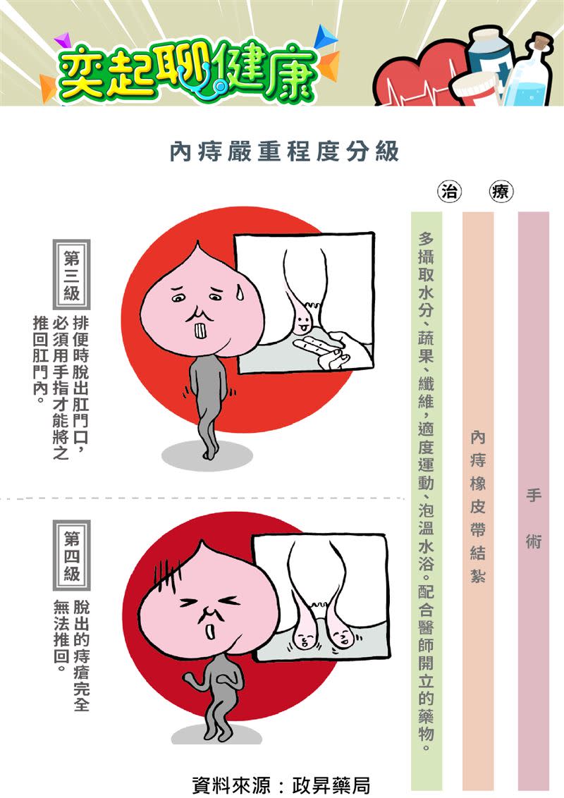 痔瘡依照嚴重程度有分成4級，會影響症狀疼痛程度和治療方。（圖／政昇藥局提供）