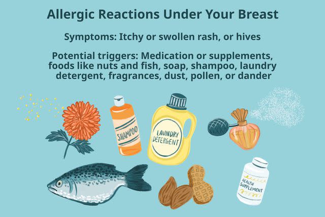 Rash Under Breast: What It Means - Yahoo Sports