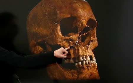 Project osteologist Jo Appleby points out the damage to a skull, believed to be that of Richard III, during a news conference in Leicester, central England, in this February 4, 2013 file photograph. REUTERS/Darren Staples/Files