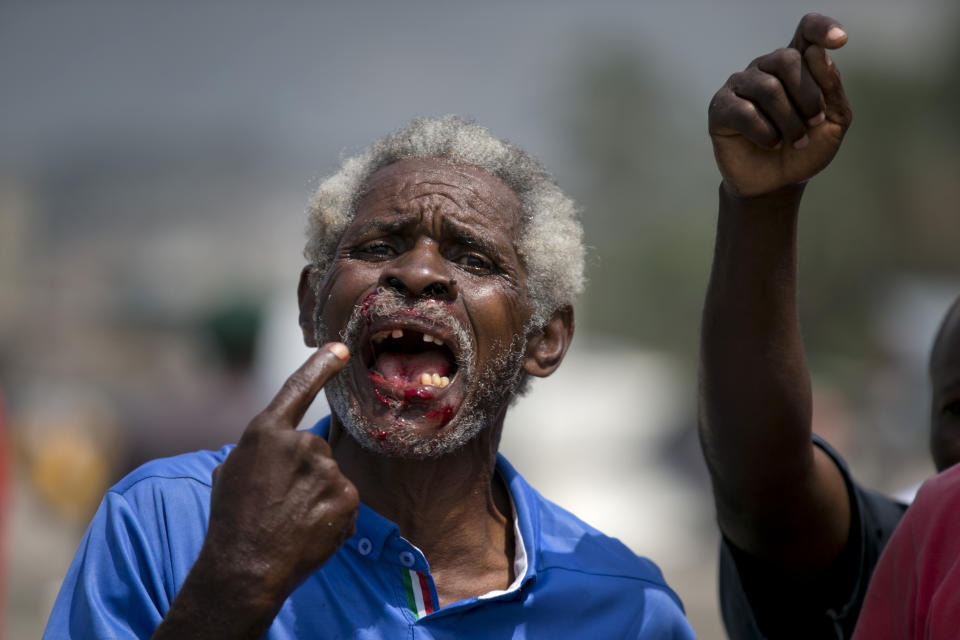 In this Sept. 11, 2019 photo, a demonstrator that was injured in the mouth by a rubber bullet fired by the police, protests during clashes in front of the parliament, before the ratification of designate Prime Minister Fritz William Michel in Port-au-Prince, Haiti. Fritz William Michel and his cabinet are awaiting in parliament for his ratification as Prime Minster. (AP Photo/Dieu Nalio Chery)