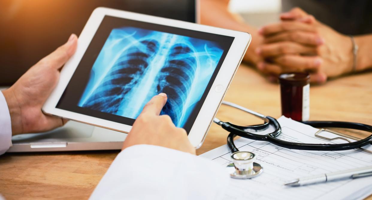 Man pointing at lung test