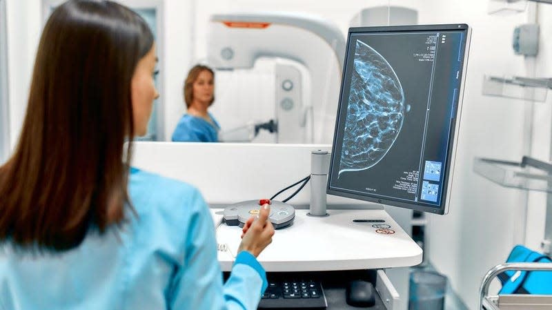 AI tool can help radiologists screen for breast cancer