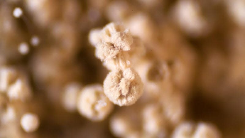 An Aspergillus mold under a microscope.