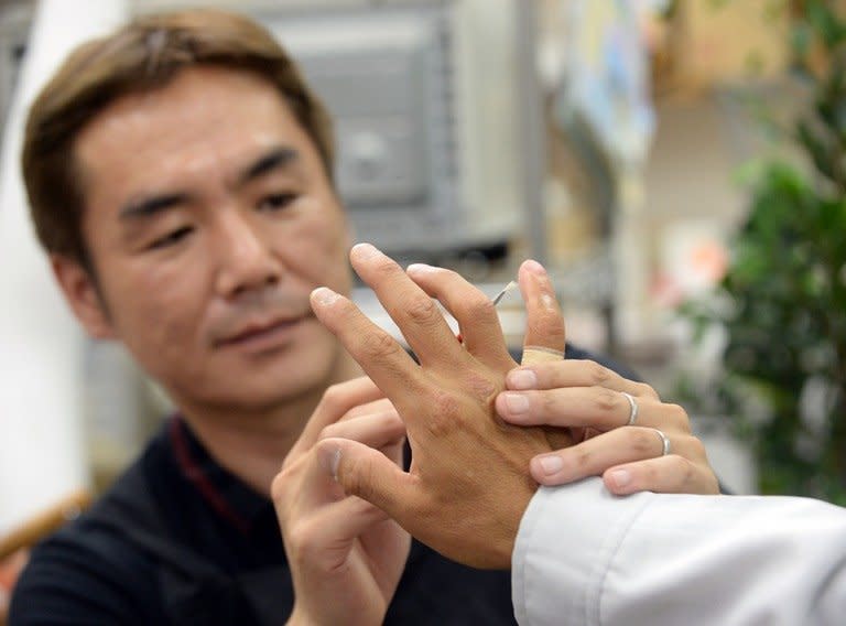 Prosthetics specialist Shintaro Hayashi (L) checks a silicone-made finger of a 53-year-old former yakuza gangster, at his office in Tokyo, on on May 27, 2013. Going straight after a lifetime spent as a member of Japan's feared yakuza organised crime mobs poses a number of challenges. Chief among them is what to do about the fingers you chopped off