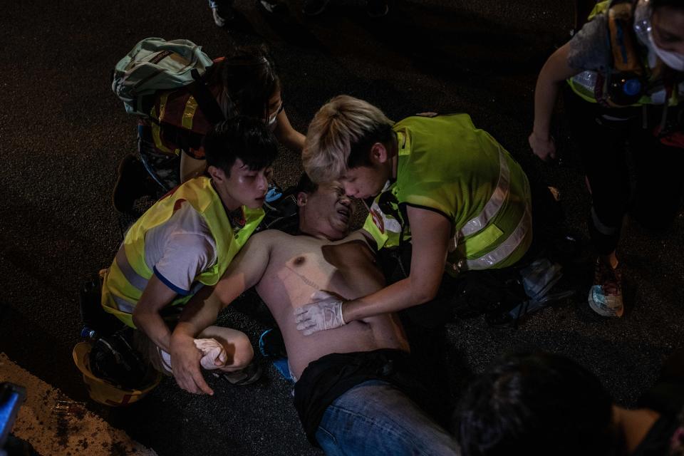 A man who tried to break a blockage of barricades in Central was attacked by protesters. Paramedics attended the man after he felt unconscious.   (Photo: Ivan Abreu/SOPA Images/LightRocket via Getty Images)