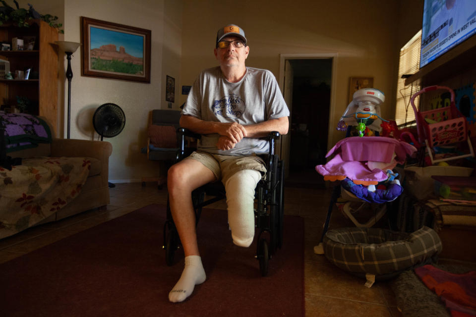 Mike Bonebrake lost a leg after a Modern Vascular procedure another surgeon says he didn't need.