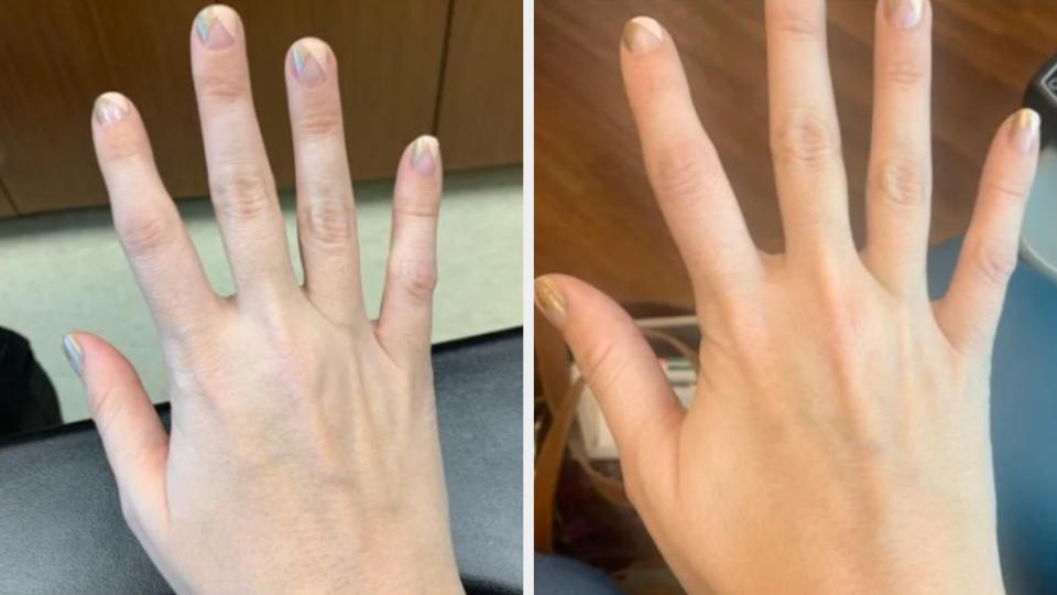 before the hand looks pale and after the hand looks healthy with more color