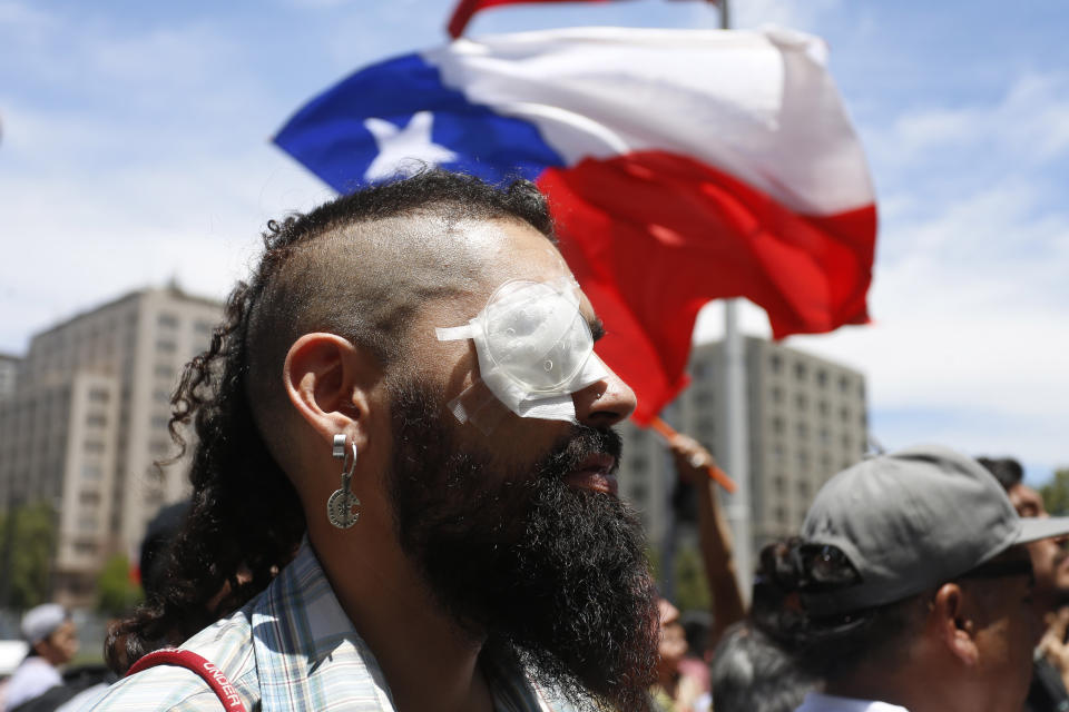 Marcelo Herrera, a demonstrator who claims he lost an eye after being shot with a shotgun by the police during the ongoing anti-government demonstrations, joins a protest in front of Palacio de La Moneda, in Santiago, Chile, Friday, Dec. 13, 2019. The United Nations released on Friday a report which stated that there have been serious violations of human rights during the repression of recent protests in Chile. (AP Photo/Luis Hidalgo)