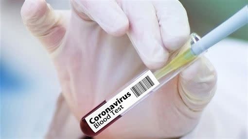 武漢肺炎疫情蔓延，許多國家致力於研發疫苗。（示意圖／Pixabay）