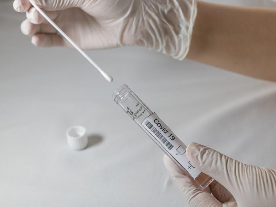 PCR tests must be done privately in most cases (Getty Images/iStockphoto)