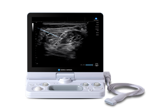 The SONIMAGE HS2 with Simple Needle Visualization (SNV).