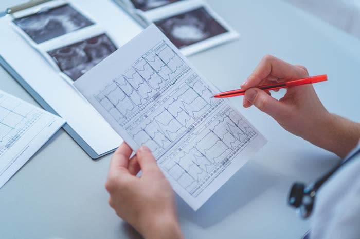 electrocardiograma