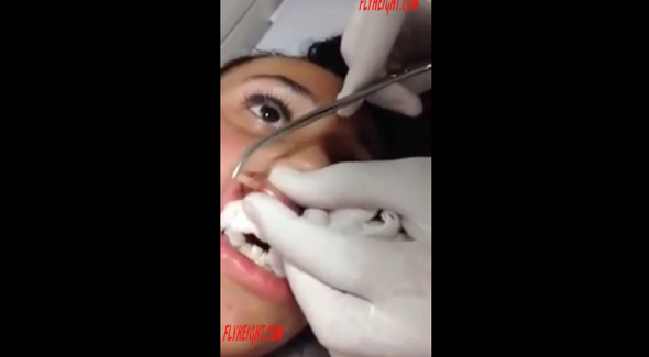 Woman has huge bot fly and egg removed from her lip (video)