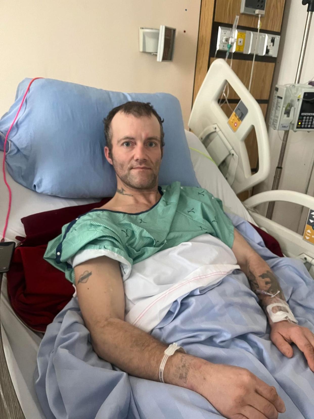 Jamie Langille, 43, of Saint John, is facing a long recovery after having his left leg amputated below the knee and half his right foot amputated on Jan. 19 due to frostbite. (Catherine Driscoll - image credit)
