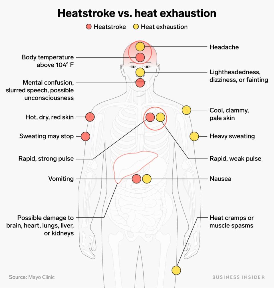 heatstroke vs. heat exhaustion