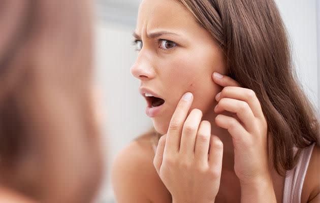 There's finally good news for acne sufferers. Photo: Getty.