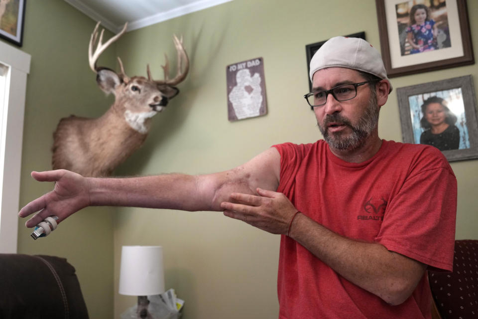 Ben Dyer talks about the injuries he suffered during the October 2023 mass shooting at Schemengee's Bar and Grille in Lewiston, Maine, at his home in Auburn, Maine, Thursday, June 6, 2024. Dyer, a lifelong hunter, survived being hit by several bullets, including one that shot off his right index finger. (AP Photo/Robert F. Bukaty)