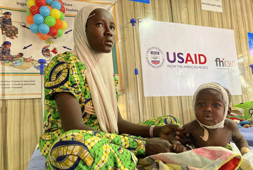 A woman attends to her malnourished child at the United Nations Nutrition Center in Banki, on the outskirts of Maiduguri, Nigeria, Tuesday, May 3, 2022. Aid agencies are warning that acute malnutrition is on the rise in northeast Nigeria. The development comes after a year of poor food production in the country and as humanitarian aid is being diverted to the crisis in Ukraine. The U.N. children's agency says acute malnutrition has soared from affecting 1.4 million children to 1.7 million over the last year. (AP Photo/Chinedu Asadu)