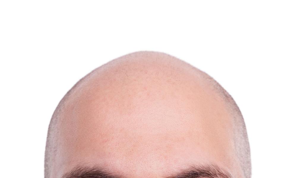 Tipp zehn: An drei Glatzköpfe denken