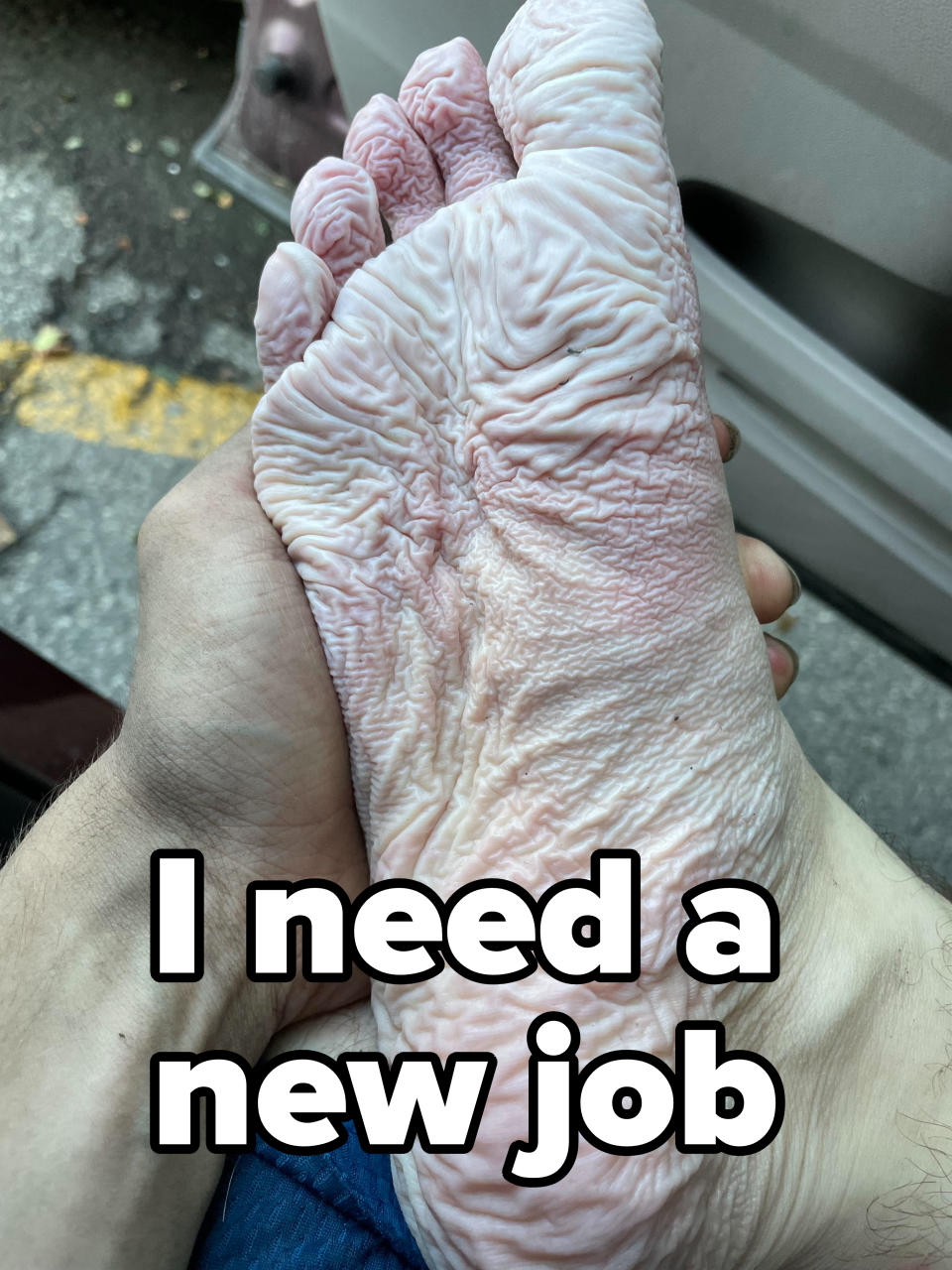 Person holding their pruney foot after it has been soaked in water