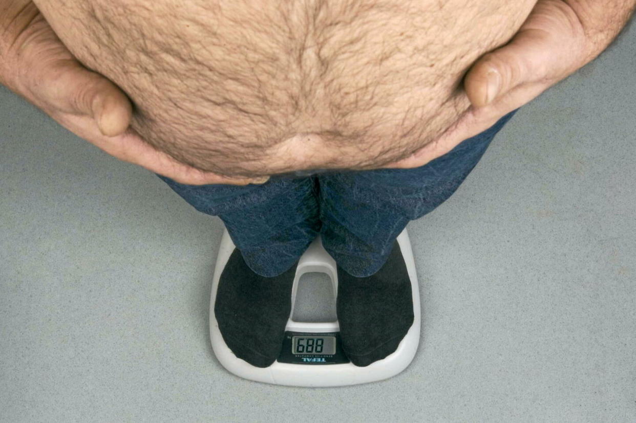 Un homme obèse en train de se peser.  - Credit:JAUBERT/SIPA / SIPA / JAUBERT/SIPA