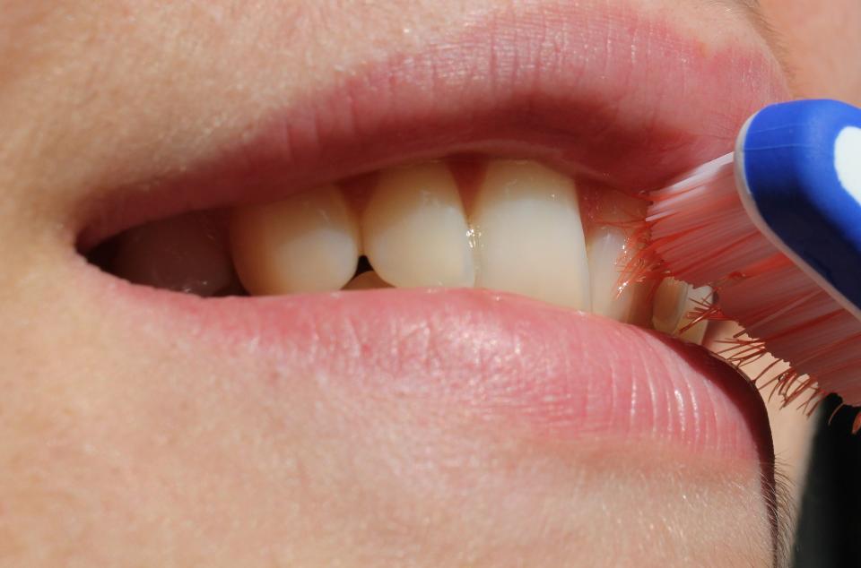 La periodontitis y la enfermedad cardíaca comparten factores de riesgo. /Foto: Pixabay