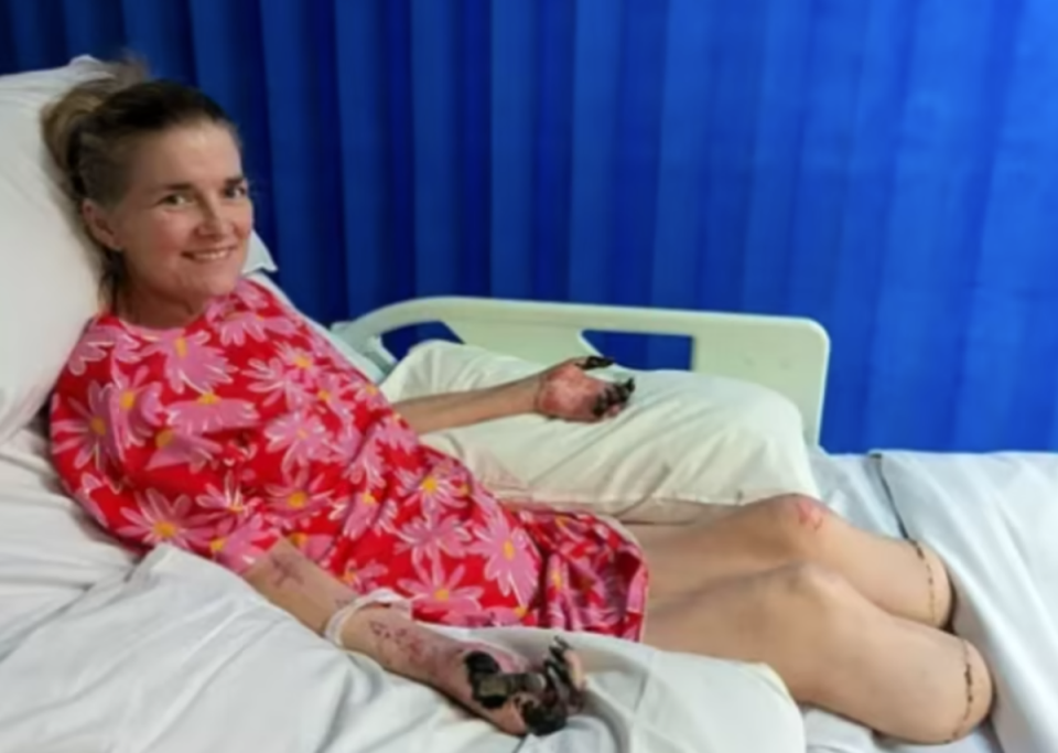 Julianna lost both her legs to sepsis (Tim Bransden)