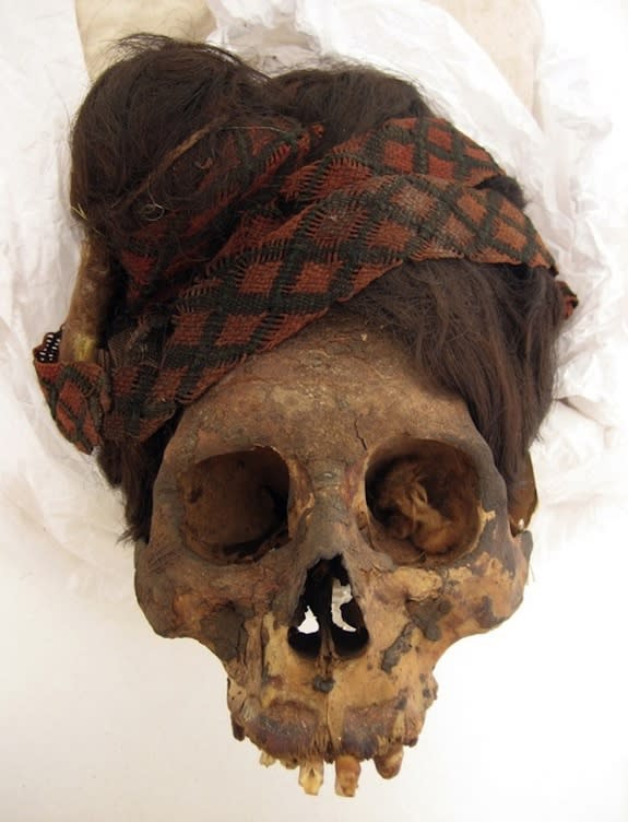 To learn more about the mummies' diets, the researchers took hair samples from 14 individuals and two hair artifacts found at the Paracas Necropolis. This individual wears a red and black headdress.