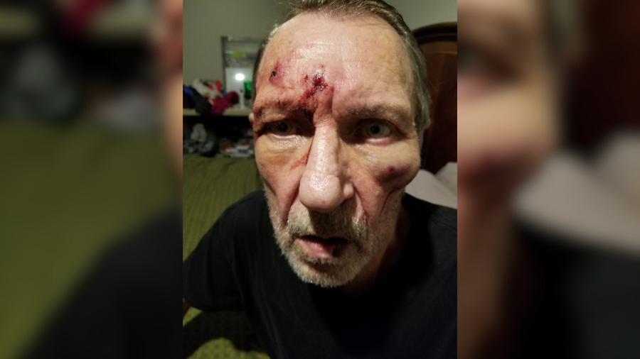 Uber driver Peter McNulty, 70, was brutally beaten by a passenger on April 21, 2024. (Peter McNulty)