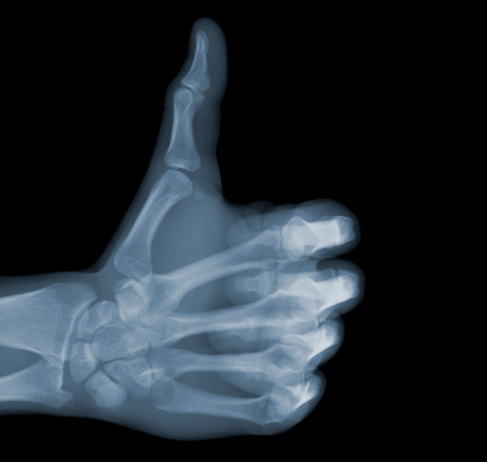 Fascinating X-ray photographs by Nick Veasey svkg 210612