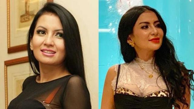 6 Artis Tanah Air Ini Pernah Suntik Filler Bibir, Terbaru Lucinta Luna