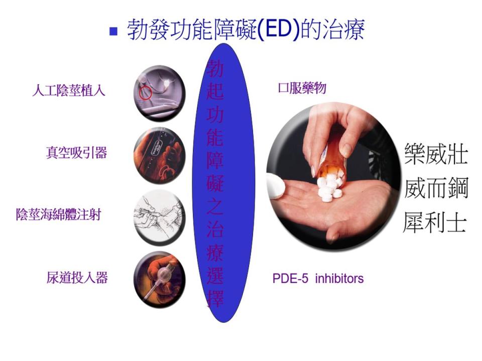 男性勃發障礙目前已經有多種治療選項，但都屬於自費項目。（圖：盧星華醫師提供）