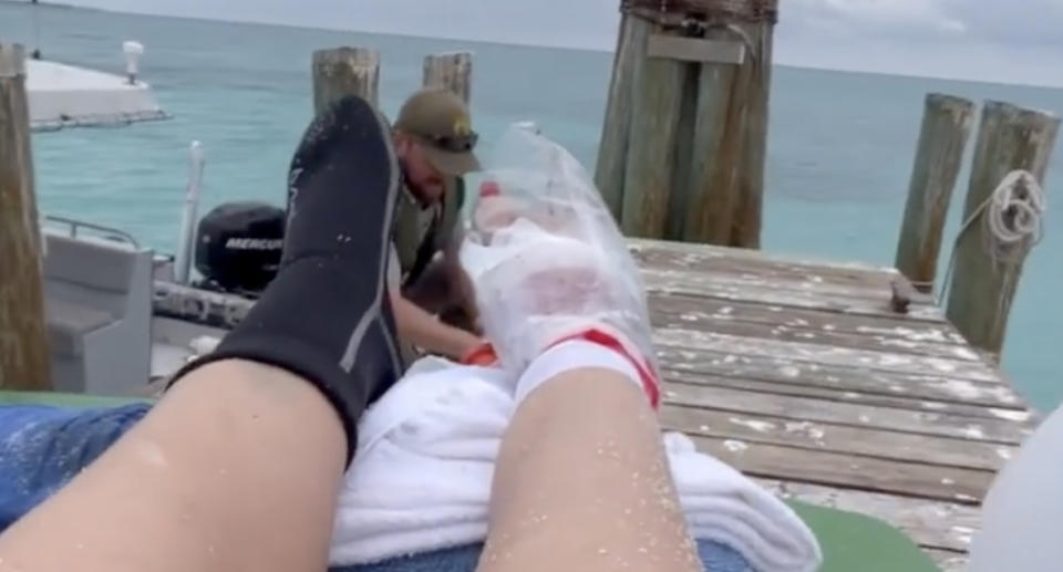 Woman fought of shark in Florida after it latched onto her foot