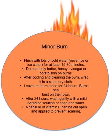 First Aid Tips: What to do in case of a minor burn