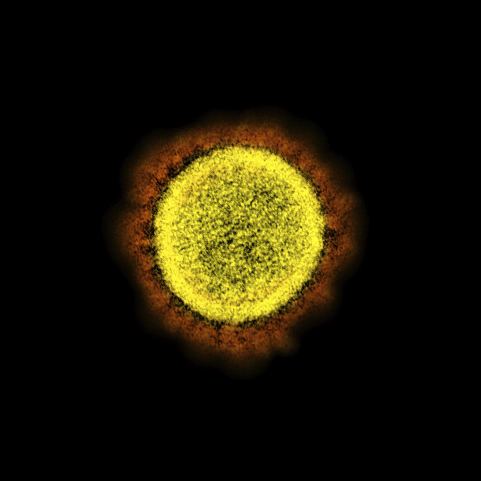 This 2020 electron micrsocope image made available by the National Institute of Allergy and Infectious Diseases shows a Novel Coronavirus SARS-CoV-2 particle isolated from a patient, in a laboratory in Fort Detrick, Md. Coronaviruses, including the newest one, are named for the spikes that cover their outer surface like a crown, or corona in Latin. Using those club-shaped spikes, the virus latches on to the outer wall of a human cell, invades it and replicates, creating viruses to hijack more cells. (NIAID/NIH via AP)