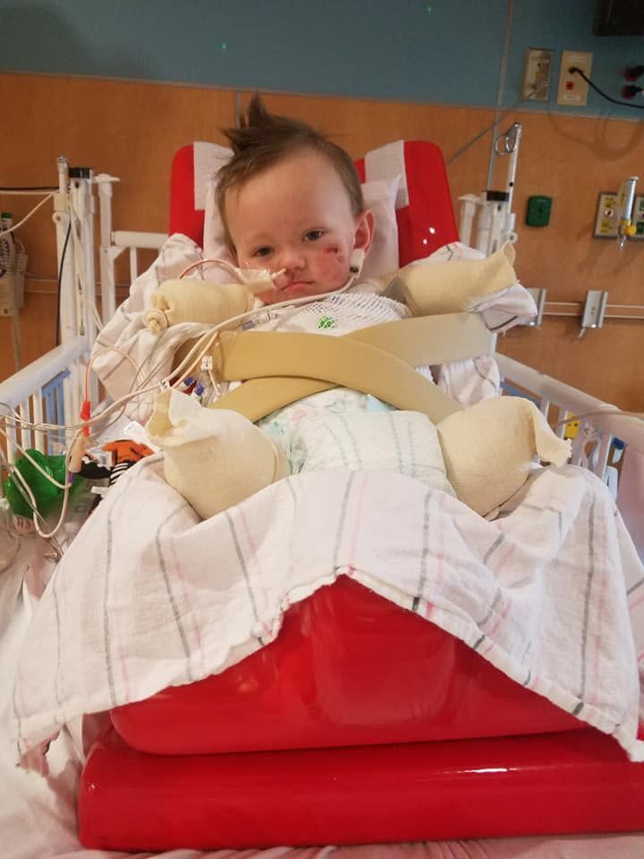 Two-year-old Jeremiah Thompson will have to relearn how to crawl and move without his limbs<em> (Photo via GoFundMe)</em>
