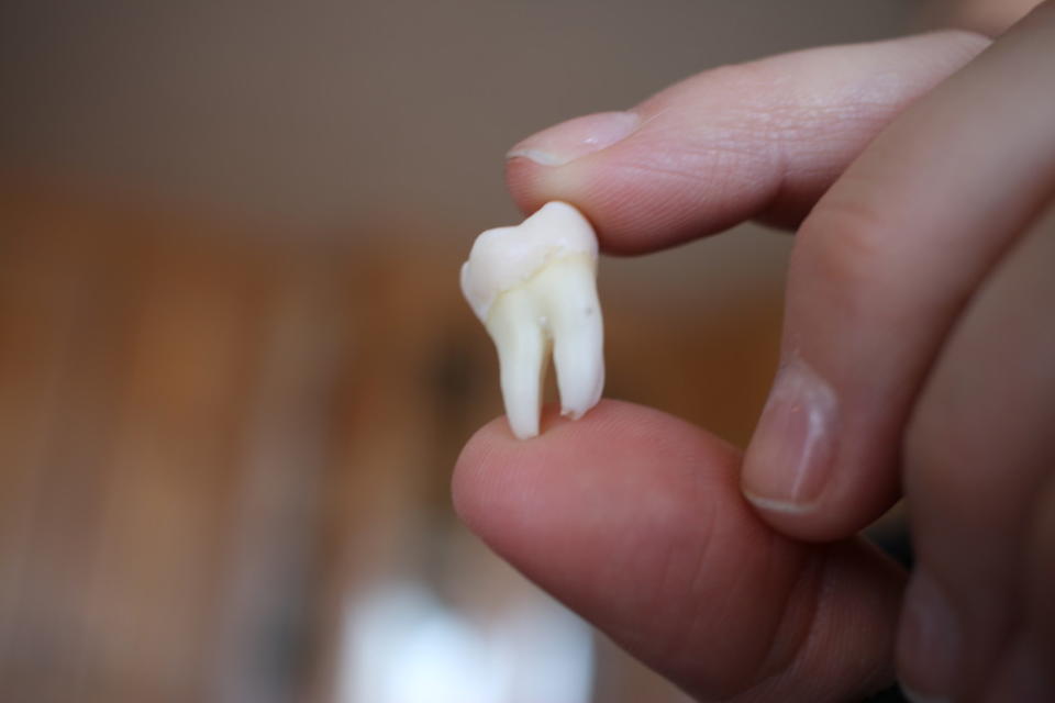 Knock out a permanent or adult tooth