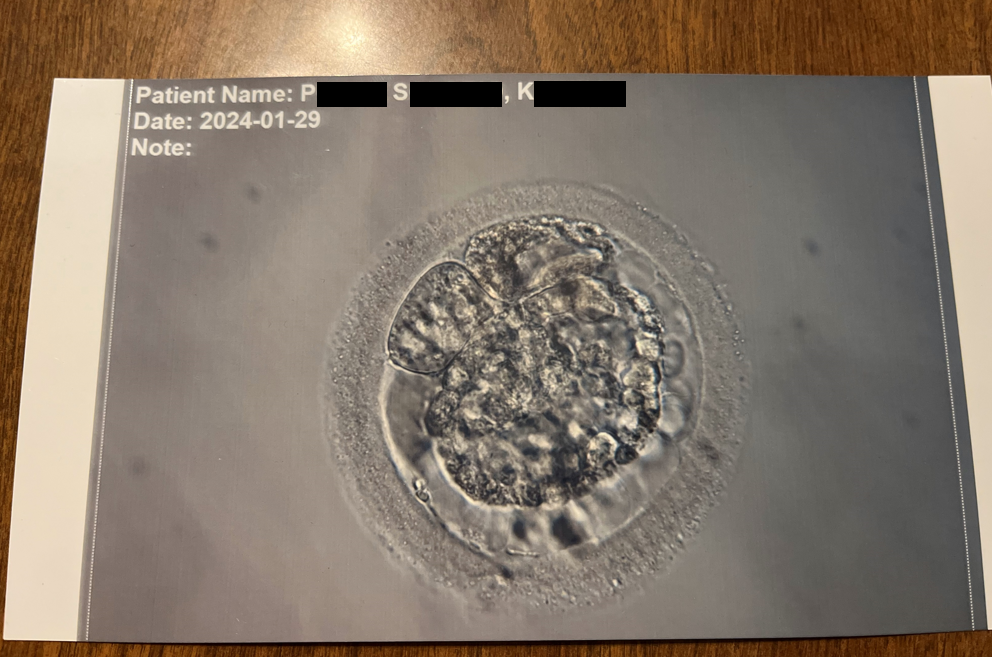 Pictured is an embryo implanted in one of the unnamed plaintiffs who sued Ovation Fertility for not disclosing an alleged laboratory incident that occurred in January 2024.