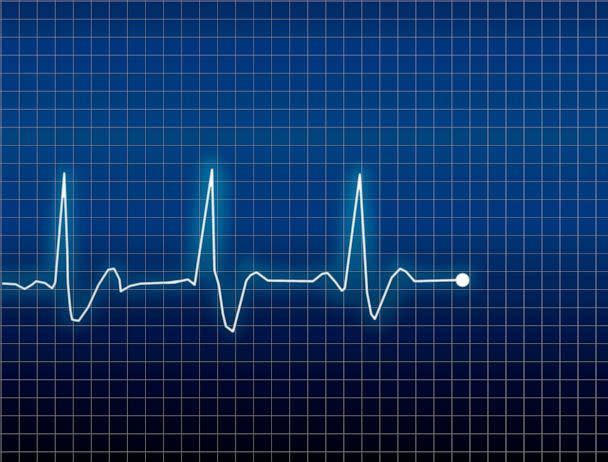 PHOTO: EKG reading (STOCK IMAGE/Getty Images)