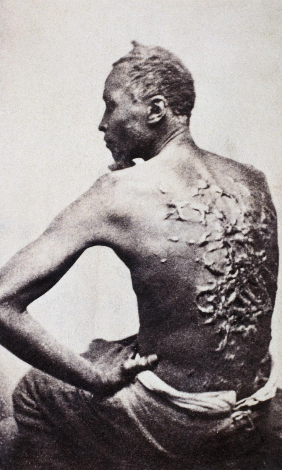 Gordon, also known as "Whipped Peter", a former enslaved man