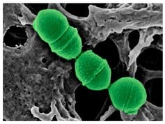 <span class="caption"><em>Streptococcus dentisani</em> de microscopía electrónica coloreada. / Anny Camelo Castillo.</span> <span class="attribution"><span class="source">FISABIO</span>, <span class="license">Author provided</span></span>