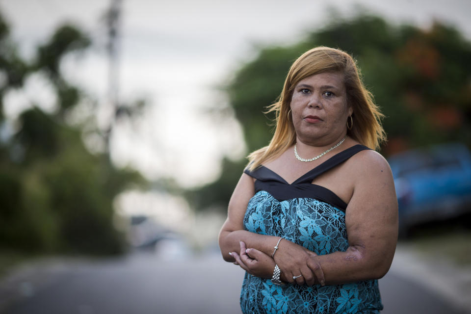 Rivera Acosta stands outside of her home in Vieques. The mother of two said the long journey to the main island for treatment prevents her from taking care of her children.&nbsp; (Photo: Dennis M. Rivera Pichardo for HuffPost)