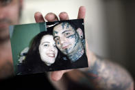 <p>In this Aug. 2, 2011 photo, former skinhead Bryon Widner holds a photo at his home of him and his wife Julie Larsen taken before his facial tattoos were removed. After getting married in 2006, the couple, former pillars of the white power movement (she as a member of the National Alliance, he a founder of the Vinlanders gang of skinheads) had worked hard to put their racist past behind them. They had settled down and had a baby; her younger children had embraced him as a father. But leaving the old life would not be easy when it was all he had known – and when his face remained a billboard of hate. (Photo: Jae C. Hong/AP) </p>