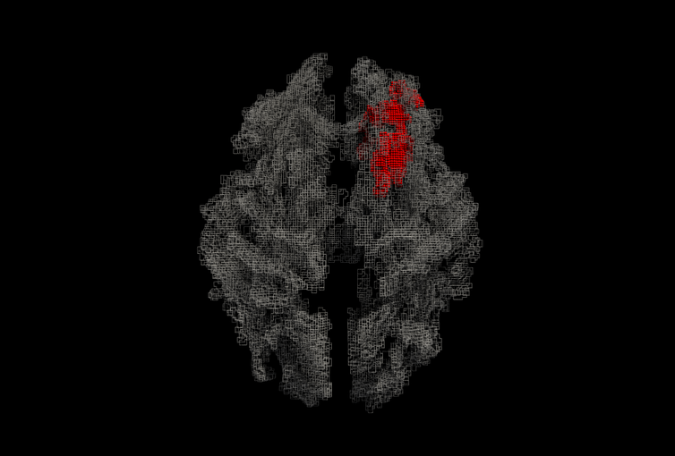 <span class="caption">White matter map of the brain (ray traced rendering), with the area correlated with spontaneity in red.</span> <span class="attribution"><span class="source">Parashkev Nachev</span>, <span class="license">Author provided</span></span>