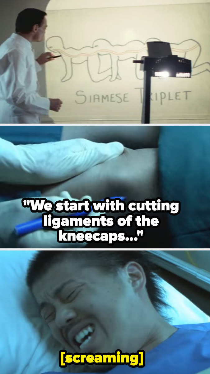 A doctor drawing a "Siamese triplet" and a person screaming in a hospital bed