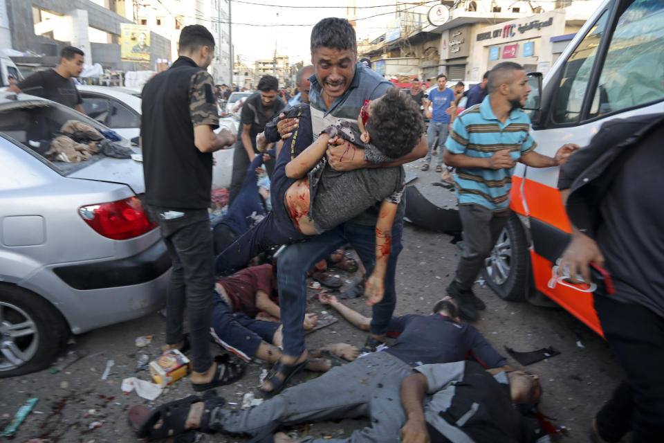 FILE - A man steps over the bodies of dead and injured Palestinians lying on the ground following an Israeli airstrike outside the entrance of the al-Shifa Hospital in Gaza City, Gaza Strip, Friday, Nov. 3, 2023. News organizations are constantly weighing their job to convey reality against the concern that violent images are too traumatizing for consumers to see. (AP Photo/Abed Khaled, File)