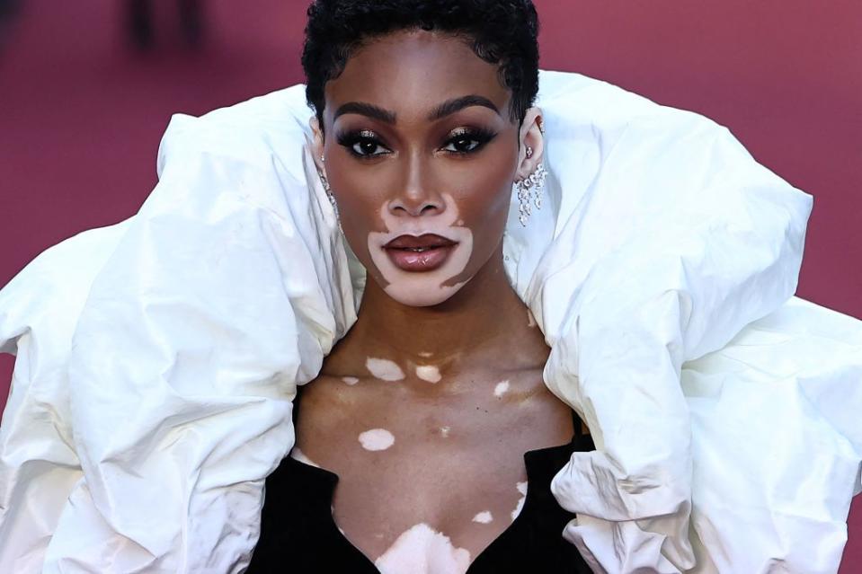 canadian model winnie harlow poses upon arrival to attend the vogue world london event at the theatre royal drury lane in central london on the eve of london fashion week on september 14, 2023 photo by henry nicholls afp photo by henry nichollsafp via getty images