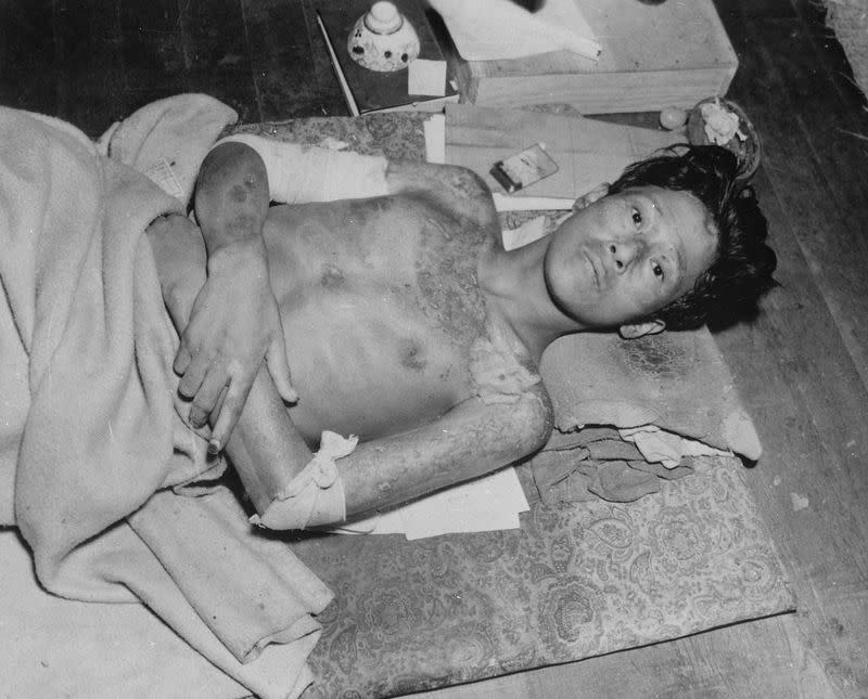 FILE PHOTO: A man being treated for wounds caused by the atomic bomb is seen in Nagasaki