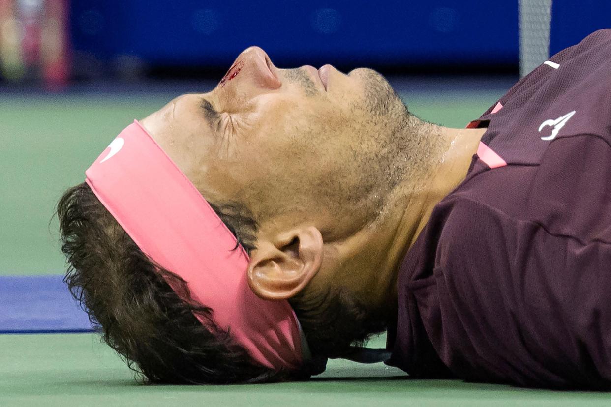 Spain's Rafael Nadal lies on the court and seeks medical attention after hitting himself in the face with his racket during his 2022 U.S. Open Tennis tournament men's singles second round match against Italy's Fabio Fognini at the USTA Billie Jean King National Tennis Center in New York on Sept. 1, 2022.