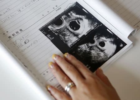 Sayaka Osakabe, founder of "Matahara net," a support group calling for legislation outlining more support for working women, displays her medical record showing ultrasound images of her seven-week old twin babies, in her house in Kawasaki, south of Tokyo September 11, 2014. REUTERS/Yuya Shino